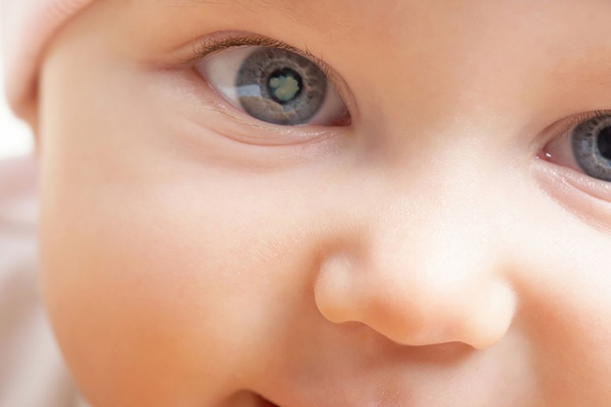 O que é catarata congênita: Conheça um dos principais responsáveis pela cegueira infantil - SunKids