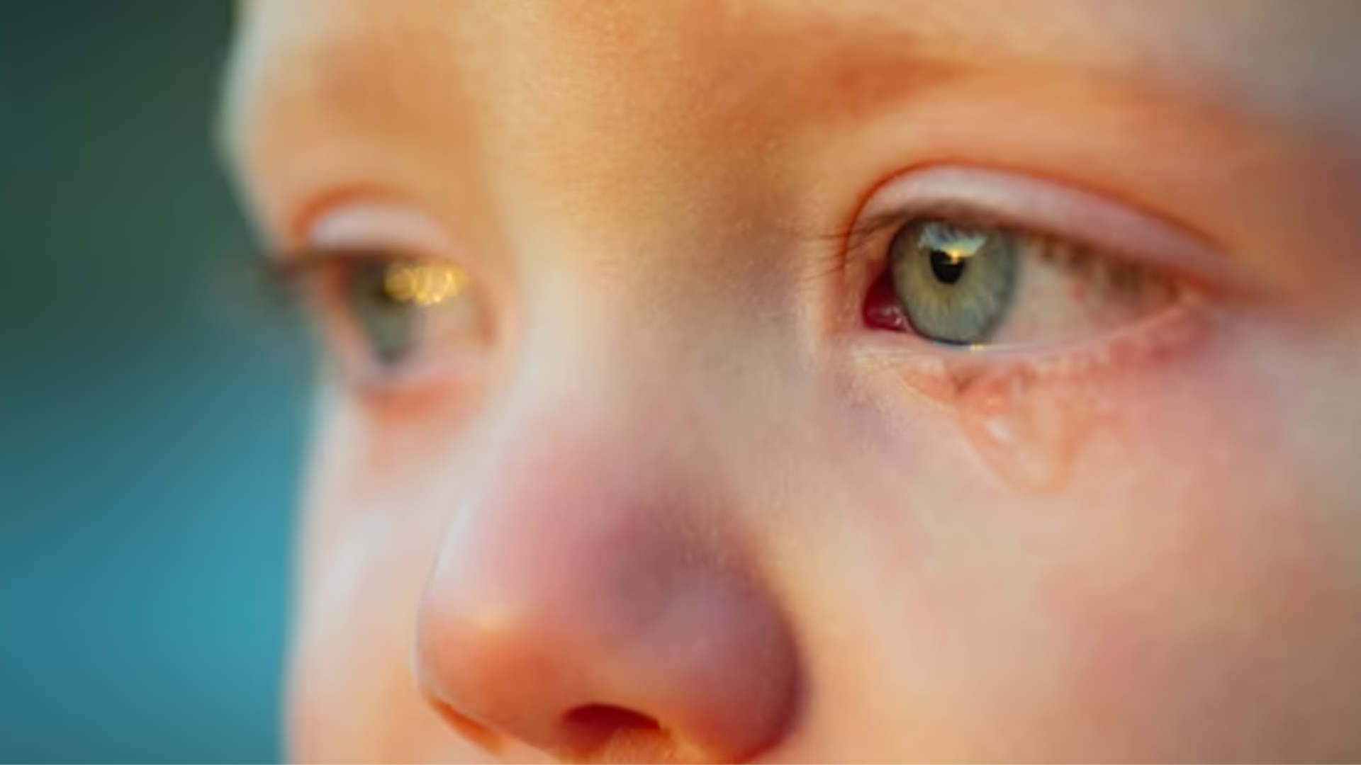 Lesões oculares em crianças: o que fazer em caso de acidente?