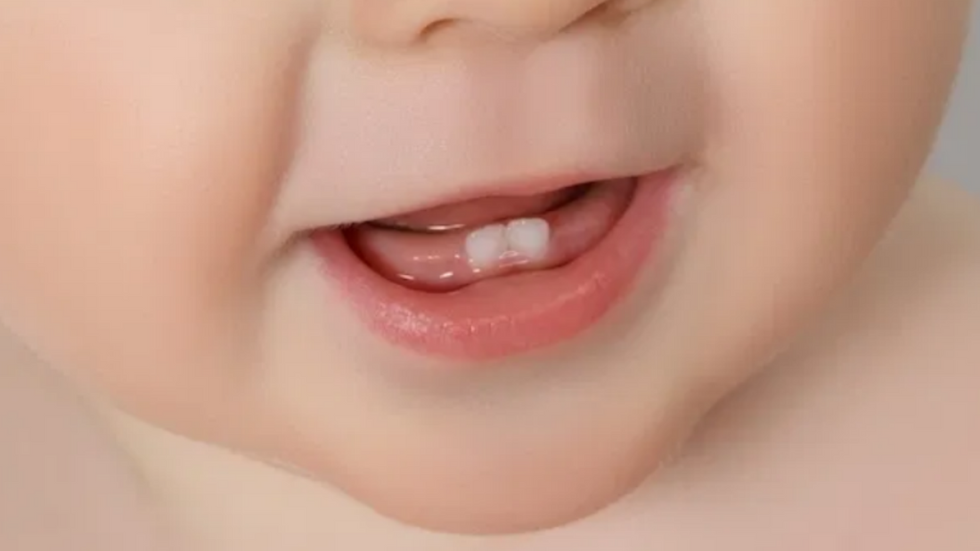 Veja como aliviar a dor dos primeiros dentes do bebê! 
