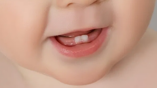 Veja como aliviar a dor dos primeiros dentes do bebê! 